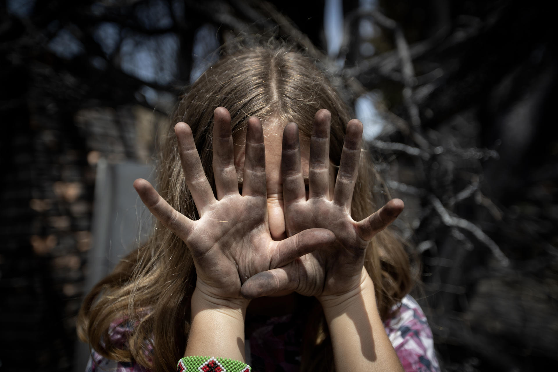 Fotografía de archivo que muestra a una niña de 12 años cubriéndose la cara con las manos manchadas de hollín. EFE/ Villar López
