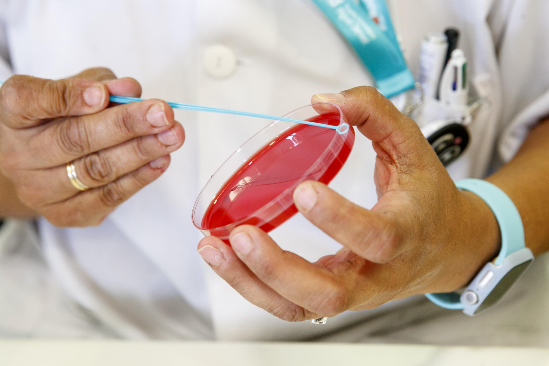 Los casos de sífilis en EE.UU. aumentan a los niveles más altos en los últimos 70 años Archivo. EFE/Javier Cebollada